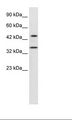 PNMA1 / MA1 Antibody - Jurkat Cell Lysate.  This image was taken for the unconjugated form of this product. Other forms have not been tested.
