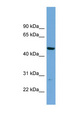 PNMAL1 Antibody - PNMAL1 antibody Western blot of HepG2 cell lysate. This image was taken for the unconjugated form of this product. Other forms have not been tested.