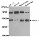 PNMAL1 Antibody - Western blot analysis of extracts of various cell lines, using PNMAL1 antibody at 1:3000 dilution. The secondary antibody used was an HRP Goat Anti-Rabbit IgG (H+L) at 1:10000 dilution. Lysates were loaded 25ug per lane and 3% nonfat dry milk in TBST was used for blocking. An ECL Kit was used for detection and the exposure time was 60s.