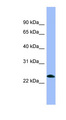 PNOC / Nociceptin Antibody - PNOC / Nociceptin antibody Western blot of HepG2 cell lysate. This image was taken for the unconjugated form of this product. Other forms have not been tested.