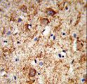PNOC / Nociceptin Antibody - Formalin-fixed and paraffin-embedded human brain tissue reacted with PNOC Antibody , which was peroxidase-conjugated to the secondary antibody, followed by DAB staining. This data demonstrates the use of this antibody for immunohistochemistry; clinical relevance has not been evaluated.