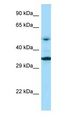 PNPLA2 / ATGL Antibody - PNPLA2 / ATGL antibody Western Blot of MCF7 Cell. Antibody dilution: 1 ug/ml.  This image was taken for the unconjugated form of this product. Other forms have not been tested.
