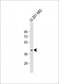 PNPLA5 Antibody - Anti-PNPLA5 Antibody (Center) at 1:2000 dilution + U-251 MG whole cell lysate Lysates/proteins at 20 µg per lane. Secondary Goat Anti-Rabbit IgG, (H+L), Peroxidase conjugated at 1/10000 dilution. Predicted band size: 48 kDa Blocking/Dilution buffer: 5% NFDM/TBST.