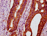 POC5 Antibody - Immunohistochemistry Dilution at 1:300 and staining in paraffin-embedded human colon cancer performed on a Leica BondTM system. After dewaxing and hydration, antigen retrieval was mediated by high pressure in a citrate buffer (pH 6.0). Section was blocked with 10% normal Goat serum 30min at RT. Then primary antibody (1% BSA) was incubated at 4°C overnight. The primary is detected by a biotinylated Secondary antibody and visualized using an HRP conjugated SP system.
