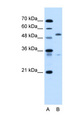 PODXL / Podocalyxin Antibody - PODXL antibody ARP44729_T100-NP_005388-PODXL(podocalyxin-like) Antibody Western blot of HepG2 cell lysate.  This image was taken for the unconjugated form of this product. Other forms have not been tested.