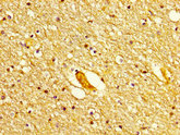 POLD1 Antibody - Immunohistochemistry image at a dilution of 1:300 and staining in paraffin-embedded human brain tissue performed on a Leica BondTM system. After dewaxing and hydration, antigen retrieval was mediated by high pressure in a citrate buffer (pH 6.0) . Section was blocked with 10% normal goat serum 30min at RT. Then primary antibody (1% BSA) was incubated at 4 °C overnight. The primary is detected by a biotinylated secondary antibody and visualized using an HRP conjugated SP system.