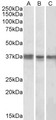 POLDIP2 / PDIP38 Antibody - Goat Anti-POLDIP2 Antibody (1µg/ml) staining of K562 (A), MCF7 (B) and Mouse Liver (C) lysates (35µg protein in RIPA buffer). Primary incubation was overnight at 4C. Detected by chemiluminescencence.