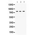 POLH / DNA Polymerase Eta Antibody - POLH antibody Western blot. All lanes: Anti POLH at 0.5 ug/ml. Lane 1: Rat Liver Tissue Lysate at 50 ug. Lane 2: HELA Whole Cell Lysate at 40 ug. Lane 3: SW620 Whole Cell Lysate at 40 ug. Predicted band size: 78 kD. Observed band size: 78 kD.