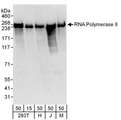 POLR2A / RNA polymerase II Antibody - Detection of Human and Mouse RNA Polymerase II by Western Blot. Samples: Whole cell lysate from 293T (15 and 50 ug for WB), HeLa (H; 50 ug), Jurkat (J; 50 ug) and mouse NIH3T3 (M; 50 ug) cells. Antibodies: Affinity purified rabbit anti-RNA Polymerase II antibody used for WB at 0.1 ug/ml. Detection: Chemiluminescence with an exposure time of 30 seconds.