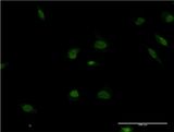 POLR2F Antibody - Immunofluorescence of monoclonal antibody to POLR2F on HeLa cell . [antibody concentration 10 ug/ml]