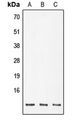 POLR2K Antibody - Western blot analysis of POLR2K expression in DLD (A); SP2/0 (B); PC12 (C) whole cell lysates.