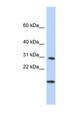 POLR2K Antibody - POLR2K antibody Western blot of Fetal Brain lysate. This image was taken for the unconjugated form of this product. Other forms have not been tested.