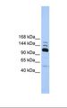 POLR3B Antibody - Fetal heart lysate. Antibody concentration: 1.0 ug/ml. Gel concentration: 6%-18%.  This image was taken for the unconjugated form of this product. Other forms have not been tested.