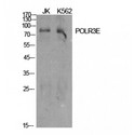 POLR3E / SIN Antibody - Western blot of POLR3E antibody