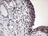 POLR3H Antibody - Immunohistochemical staining of paraffin-embedded Human bladder tissue within the normal limits using anti-POLR3H mouse monoclonal antibody. (Heat-induced epitope retrieval by 1mM EDTA in 10mM Tris buffer. (pH8.5) at 120°C for 3 min. (1:150)