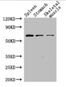 Polymyxin resistance protein MCR-1 Antibody - Positive WB detected in:Mouse spleen tissue,Mouse stomach tissue,Mouse skeletal muscle tissue;All lanes: MCR-1 antibody at 2.5ug/ml;Secondary;Goat polyclonal to rabbit IgG at 1/50000 dilution;Predicted band size: 61 kDa;Observed band size: 61 kDa;