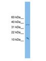 POM121C Antibody - POM121 antibody Western Blot of PANC1 cell lysate.  This image was taken for the unconjugated form of this product. Other forms have not been tested.