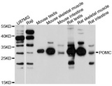 POMC / Proopiomelanocortin Antibody - Western blot analysis of extracts of various cells.