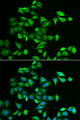 POMGNT2 / GTDC2 Antibody - Immunofluorescence analysis of A549 cells.