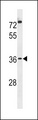 POPDC3 Antibody - POPD3 Antibody western blot of U251 cell line lysates (35 ug/lane). The POPD3 antibody detected the POPD3 protein (arrow).