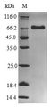 rgpA / Gingipain R1 Protein - (Tris-Glycine gel) Discontinuous SDS-PAGE (reduced) with 5% enrichment gel and 15% separation gel.
