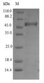 DODA Protein - (Tris-Glycine gel) Discontinuous SDS-PAGE (reduced) with 5% enrichment gel and 15% separation gel.