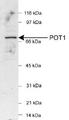 POT1 Antibody - Detection of POT1 in HeLa nuclear extracts (25 ug) using POT1  Antibody (1:500). ECL detection 1 min.  This image was taken for the unconjugated form of this product. Other forms have not been tested.