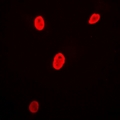 POU6F1 / BRN5 Antibody - Immunofluorescent analysis of Brn-5 staining in MCF7 cells. Formalin-fixed cells were permeabilized with 0.1% Triton X-100 in TBS for 5-10 minutes and blocked with 3% BSA-PBS for 30 minutes at room temperature. Cells were probed with the primary antibody in 3% BSA-PBS and incubated overnight at 4 deg C in a humidified chamber. Cells were washed with PBST and incubated with a DyLight 594-conjugated secondary antibody (red) in PBS at room temperature in the dark.
