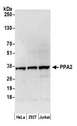 PPA2 Antibody - Detection of human PPA2 by western blot. Samples: Whole cell lysate (50 µg) from HeLa, HEK293T, and Jurkat cells prepared using NETN lysis buffer. Antibody: Affinity purified rabbit anti-PPA2 antibody used for WB at 0.1 µg/ml. Detection: Chemiluminescence with an exposure time of 30 seconds.