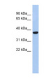 PPAPDC2 Antibody - PPAPDC2 antibody Western blot of Fetal Heart lysate. This image was taken for the unconjugated form of this product. Other forms have not been tested.