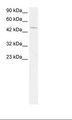 PPARA / PPAR Alpha Antibody - Jurkat Cell Lysate.  This image was taken for the unconjugated form of this product. Other forms have not been tested.