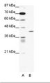 PPARD / PPAR Delta Antibody - A: Marker, B: Jurkat Cell Lysate.  This image was taken for the unconjugated form of this product. Other forms have not been tested.