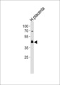 PPARD / PPAR Delta Antibody - PPARD Antibody western blot of human placenta tissue lysates (35 ug/lane). The PPARD antibody detected the PPARD protein (arrow).