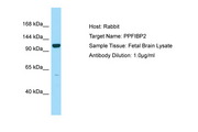 PPFIBP2 Antibody -  This image was taken for the unconjugated form of this product. Other forms have not been tested.