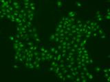 PPHLN1 Antibody - Immunofluorescence staining of PPHLN1 in A431 cells. Cells were fixed with 4% PFA, permeabilzed with 0.1% Triton X-100 in PBS, blocked with 10% serum, and incubated with rabbit anti-Human PPHLN1 polyclonal antibody (dilution ratio 1:1000) at 4°C overnight. Then cells were stained with the Alexa Fluor 488-conjugated Goat Anti-rabbit IgG secondary antibody (green). Positive staining was localized to Nucleus.