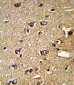 PPIA / Cyclophilin A Antibody - Formalin-fixed and paraffin-embedded human brain tissue reacted with PPIA Antibody , which was peroxidase-conjugated to the secondary antibody, followed by DAB staining. This data demonstrates the use of this antibody for immunohistochemistry; clinical relevance has not been evaluated.