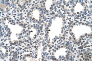 PPIB / Cyclophilin B Antibody - PPIB / Cyclophilin B antibody ARP44365_T100-NP_000933-PPIB(peptidylprolyl isomerase B (cyclophilin B)) Antibody IHC of formalin-fixed, paraffin-embedded human Lung. Positive label: Alveolar cells indicated with arrows. Antibody concentration 4-8 ug/ml. Magnification 400X.  This image was taken for the unconjugated form of this product. Other forms have not been tested.