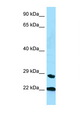 PPIC / Cyclophilin C Antibody - PPIC antibody Western blot of Small Intestine lysate. Antibody concentration 1 ug/ml.  This image was taken for the unconjugated form of this product. Other forms have not been tested.