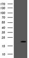 PPIL3 Antibody - HEK293T cells were transfected with the pCMV6-ENTRY control (Left lane) or pCMV6-ENTRY PPIL3 (Right lane) cDNA for 48 hrs and lysed. Equivalent amounts of cell lysates (5 ug per lane) were separated by SDS-PAGE and immunoblotted with anti-PPIL3.