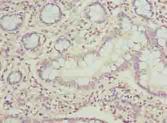 PPIL3 Antibody - Immunohistochemistry of paraffin-embedded human small intestine tissue using antibody at dilution of 1:100.
