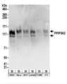 PPIP5K2 / HISPPD1 Antibody - Detection of Human and Mouse PPIP5K2 by Western Blot. Samples: Whole cell lysate (50 ug) from K562, HeLa, 293T, Jurkat, mouse TCMK-1, and mouse NIH3T3 cells. Antibodies: Affinity purified rabbit anti-PPIP5K2 antibody used for WB at 0.4 ug/ml. Detection: Chemiluminescence with an exposure time of 10 seconds.