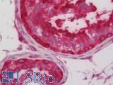 PPM1F Antibody - Human Testis: Formalin-Fixed, Paraffin-Embedded (FFPE).  This image was taken for the unconjugated form of this product. Other forms have not been tested.