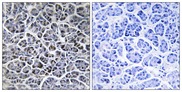 PPM1K Antibody - Immunohistochemistry analysis of paraffin-embedded human pancreas tissue, using PPM1K Antibody. The picture on the right is blocked with the synthesized peptide.