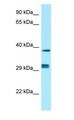 PPP1CB Antibody - PPP1CB antibody Western Blot of Fetal Kidney.  This image was taken for the unconjugated form of this product. Other forms have not been tested.