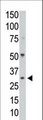 PPP1CC / PP1 Gamma Antibody - The anti-PPP1CC antibody is used in Western blot to detect PPP1CC in mouse colon tissue lysate.