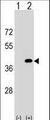 PPP1CC / PP1 Gamma Antibody - Western blot of PPP1CC (arrow) using rabbit polyclonal PPP1CC Antibody. 293 cell lysates (2 ug/lane) either nontransfected (Lane 1) or transiently transfected (Lane 2) with the PPP1CC gene.