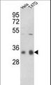 PPP1CC / PP1 Gamma Antibody - Western blot of hPPP1CC-A306 in HeLa, T47D cell line lysates (35 ug/lane). PPP1CC (arrow) was detected using the purified antibody.