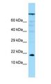 PPP1R14A / CPI-17 Antibody - PPP1R14A / CPI-17 antibody Western Blot of PANC1.  This image was taken for the unconjugated form of this product. Other forms have not been tested.