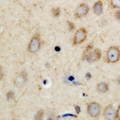 PPP1R14A / CPI-17 Antibody - Immunohistochemical analysis of CPI17 staining in human brain formalin fixed paraffin embedded tissue section. The section was pre-treated using heat mediated antigen retrieval with sodium citrate buffer (pH 6.0). The section was then incubated with the antibody at room temperature and detected with HRP and DAB as chromogen. The section was then counterstained with hematoxylin and mounted with DPX.