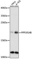 PPP1R14B Antibody - Western blot analysis of extracts of various cell lines, using PPP1R14B antibody at 1:1000 dilution. The secondary antibody used was an HRP Goat Anti-Rabbit IgG (H+L) at 1:10000 dilution. Lysates were loaded 25ug per lane and 3% nonfat dry milk in TBST was used for blocking. An ECL Kit was used for detection and the exposure time was 90s.